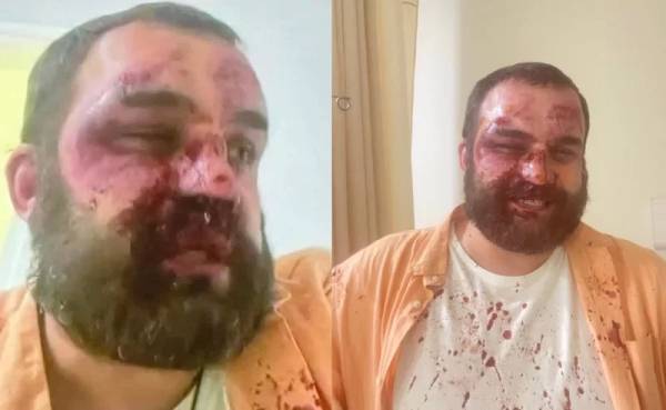 У Тбілісі напали на чотирьох активістів і представників опозиції - ЗМІ | INFBusiness