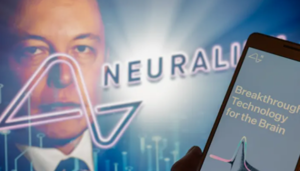 Neuralink планує вживити мозковий чип другому пацієнту | INFBusiness