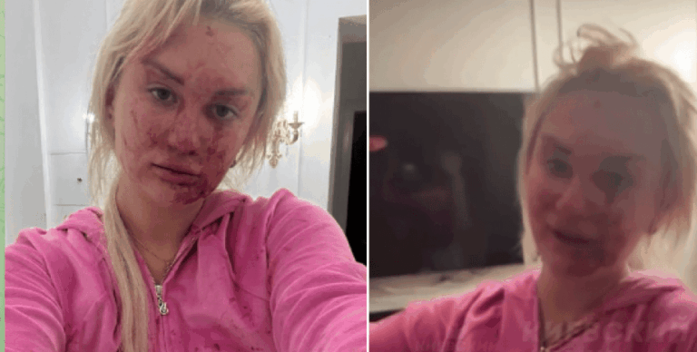 «Це мій останній день»: «Кривава» жінка скаржиться на знущання чоловіка, користувачі мережі кажуть, що це помста