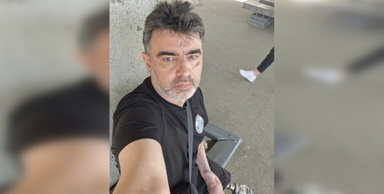 Жінка образила ветерана, бо він не приховав свій протез та травмовану руку (фото)