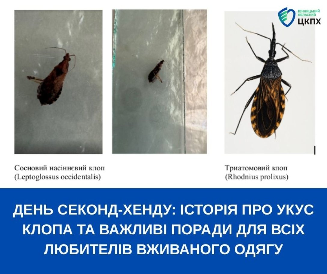 Жінку вкусив клоп під час примірки одягу в магазині секонд-хенду: що з'ясували експерти | INFBusiness