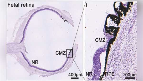 Нові клітини, виявлені в оці, можуть допомогти відновити зір, кажуть вчені | INFBusiness
