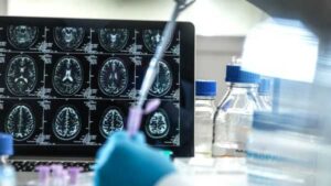 Діабет 3 типу: симптоми, причини та лікування | INFBusiness