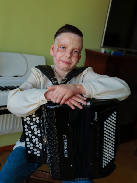 Ромчик, який дивом вижив після російського ракетного обстрілу Вінниці, нарешті зміг зняти з обличчя маску, яку носив два роки: хірурги також «зробили» дитині вушка | INFBusiness