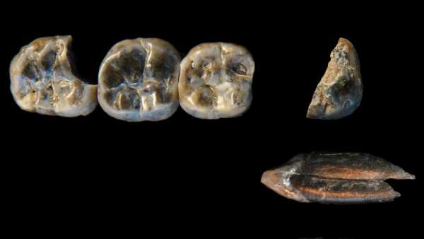 Чому зуби не вважаються кістками? | INFBusiness