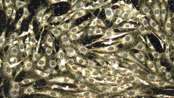 Дослідження мРНК дозволили надзвичайно швидко виготовити вакцини-кандидати проти COVID-19 під час пандемії. Але в ширшому сенсі, ця технологія може революціонізувати багато галузей медицини, що виходять за рамки профілактичних вакцин проти інфекційних захворювань. (Зображення: Адріан Асторгано) Одна молекула може започаткувати революційні ліки від раку, діабету та генетичних захворювань, але США відвертаються від неї | INFBusiness