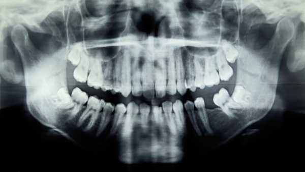 Лікарі визначили, що у маленького хлопчика є незвичайне генетичне захворювання, яке було описано в медичній літературі лише кілька сотень разів. (Зображення: Peter Cade via Getty Images) Діагностична дилема: Дитина раптово почала пахнути гниючою рибою. | INFBusiness