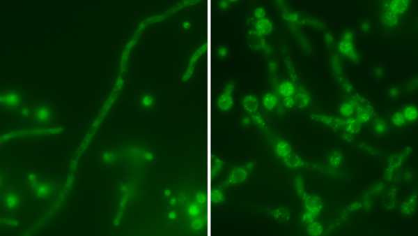 Новий антибіотик демонструє «у 100 разів» більшу ефективність проти бактерій, стійких до ліків, ніж його попередник | INFBusiness