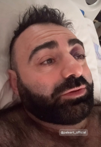 Удар головою: відомий артист потрапив до лікарні (знімки) | INFBusiness