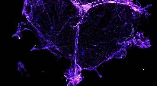 США мають намір втратити статус країни, яка ліквідувала кір, за кілька місяців. RFK має зникнути. | INFBusiness