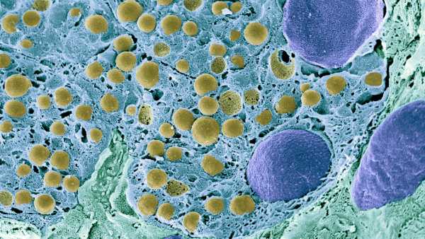 Знищення «зомбі-клітин» у кровоносних судинах може бути ключем до лікування діабету, згідно з раннім дослідженням | INFBusiness