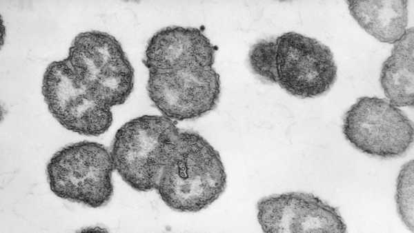 Крупний план самотнього зірчастого кліща, найчастішого розповсюджувача альфа-гал синдрому в США (Зображення: Kasey Decker via Getty Images) Чоловік з Нью-Джерсі помер від алергії на м'ясо, спричиненої укусом кліща | INFBusiness