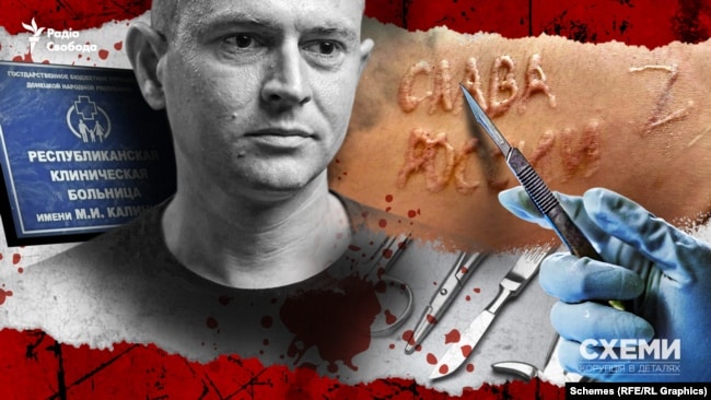 Сліпа лють: хто випалив “слава росії” на тілі полоненого?