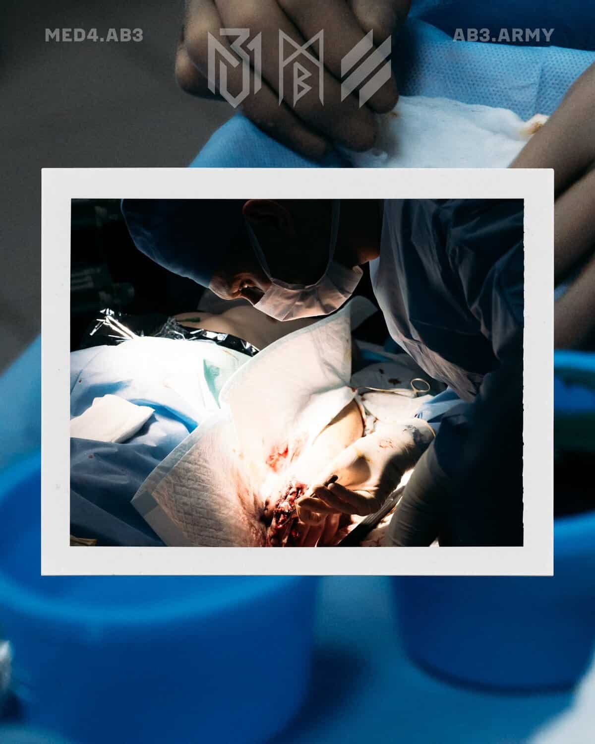 Регіонарна анестезія на стабілізаційних пунктах: переваги та виклики впровадження 5